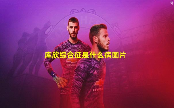 库欣综合征是什么病图片